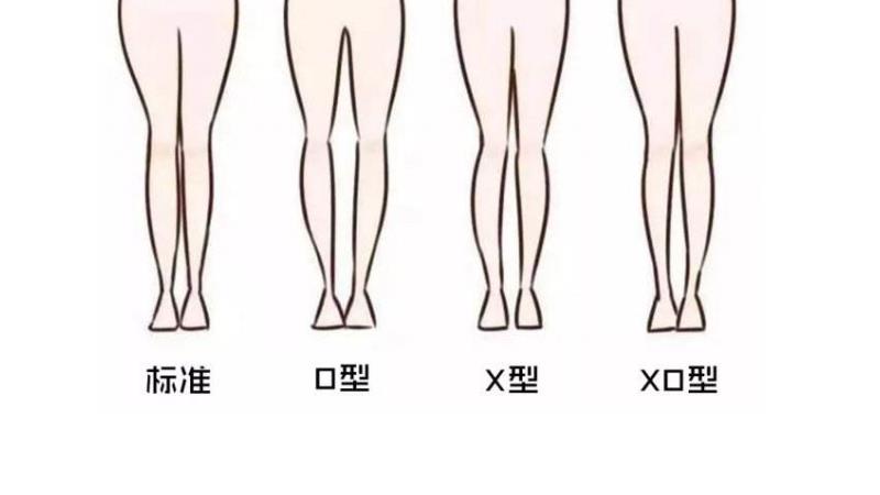 正常腿型是什么样子的图片